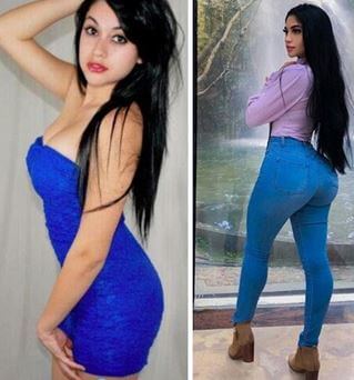 Jailyne Ojeda Ochoa before and after surgery picture.